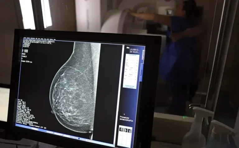 outubro-rosa:-mulheres-de-50-a-69-anos-podem-agendar-mamografia-gratuita